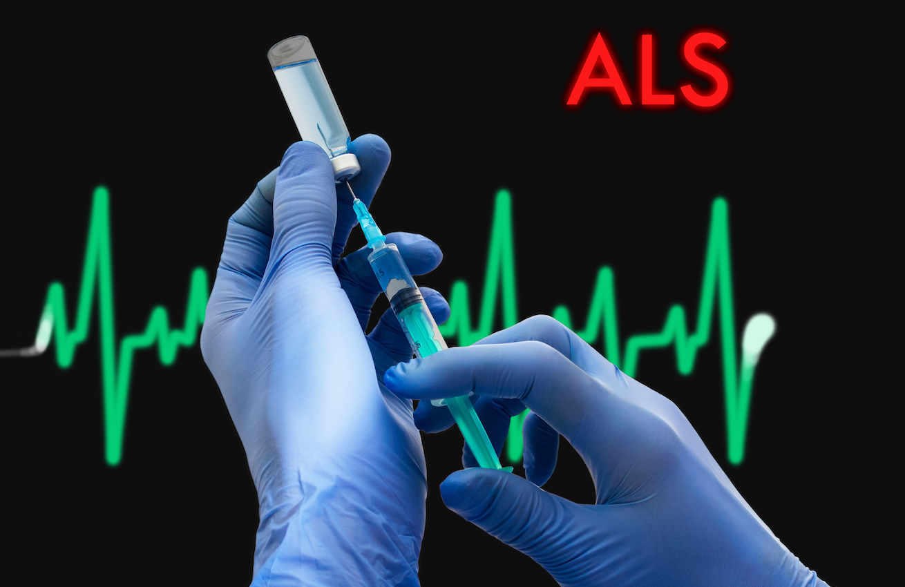 FDA Green Lights Ketamine for Treatment of ALS