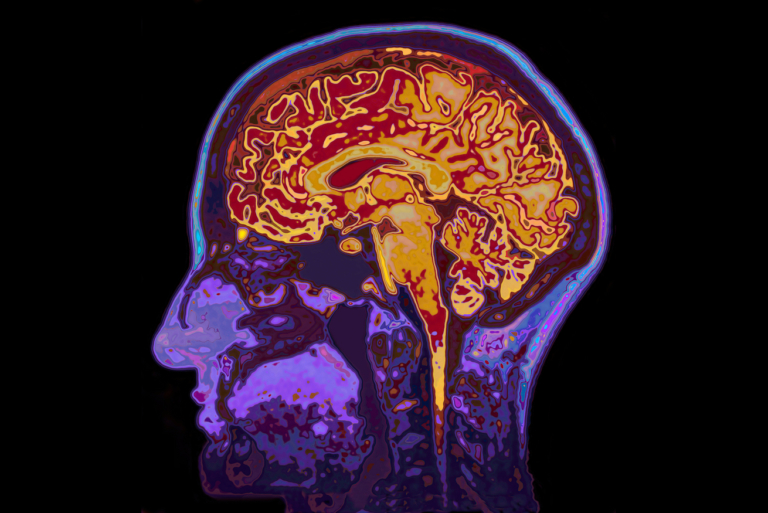 This New Company Believes Psychedelics Can Treat Dementia