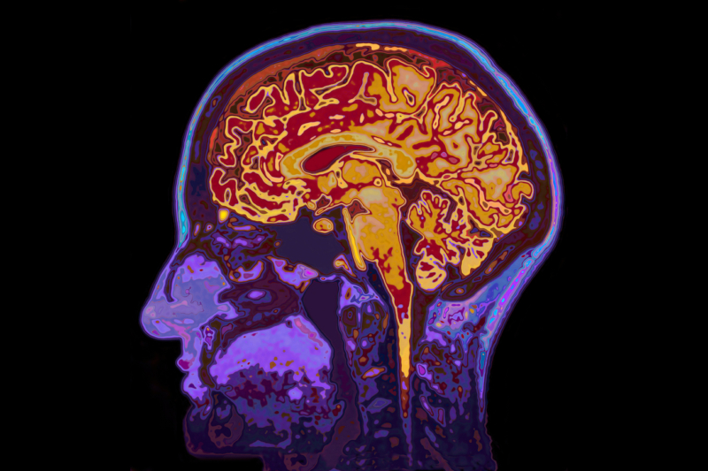 Return Health Believes Psychedelics Can Treat Dementia