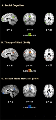 Psychedelics' Impact on the DMN, ToM and social cognition